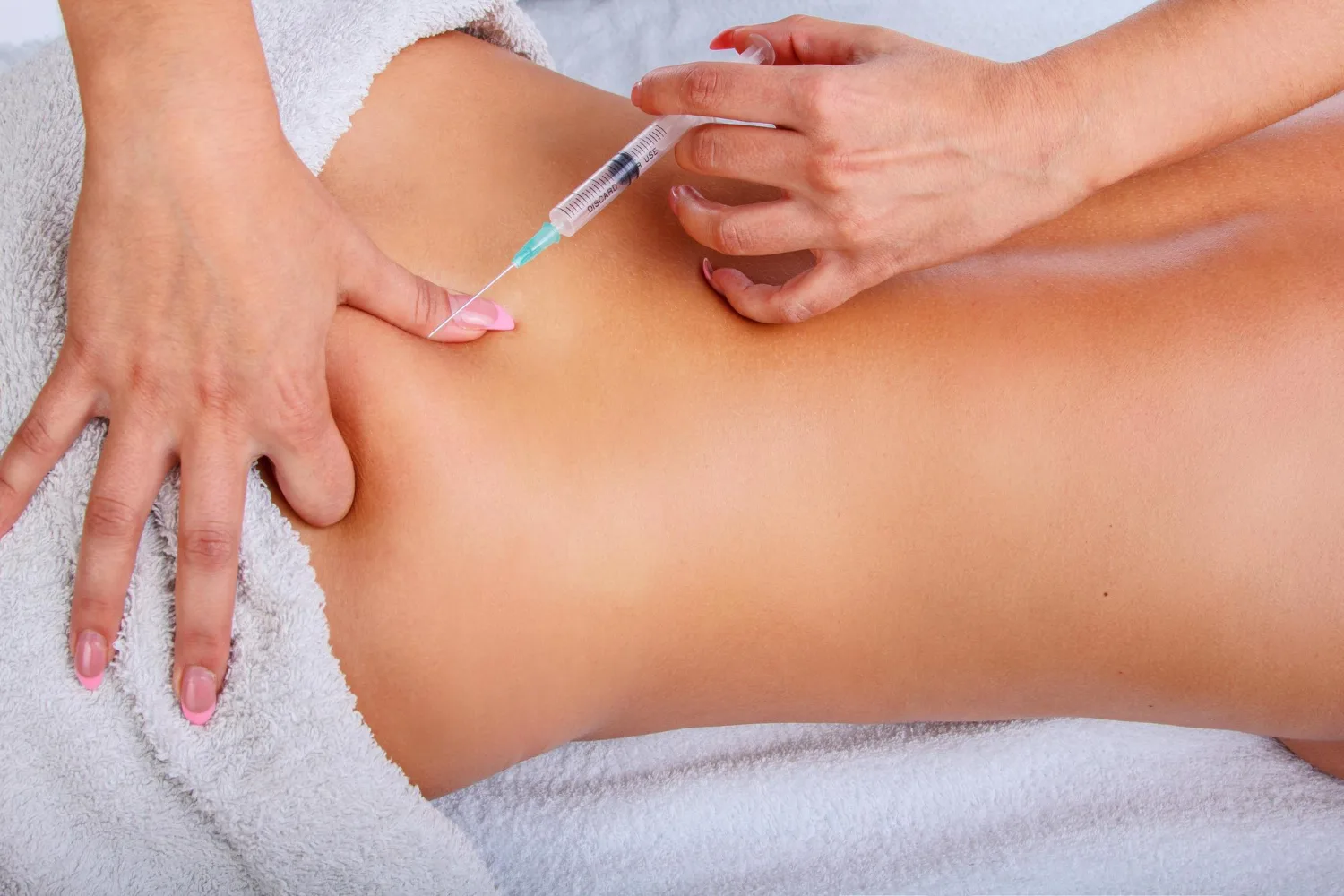 Mesoterapia
