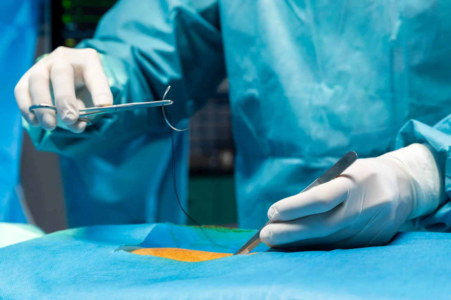 Sutura de heridas en Tijuana, B.C.: Atención médica profesional y estética